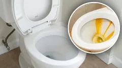 便器に長年こびりついた汚れが消えた：3つの材料で作った自家製クリーナーが効果的だった